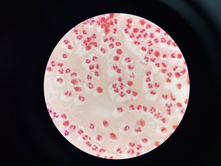 The slide shows a large number of white blood cells, appearing as round or irregularly shaped cells with distinct nuclei. These cells are scattered across the field.