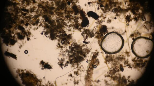 the movement of the infusorian Trichodina, which is a commensal, and is often absorbed into fish and hydras, under a microscope