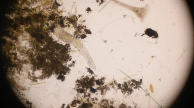 Stentor, sometimes called trumpet animalcules, are a genus of filter-feeding, heterotrophic ciliates, representative of the heterotrichs in waste water under the microscope.
