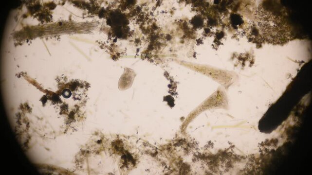 Stentor, sometimes called trumpet animalcules, are a genus of filter-feeding, heterotrophic ciliates, representative of the heterotrichs in waste water under the microscope.