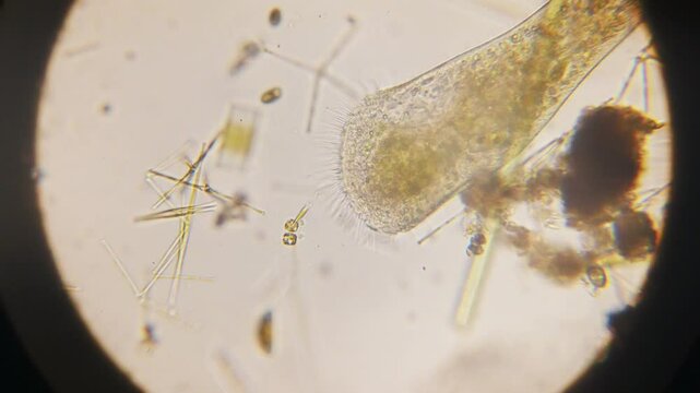 Stentor, sometimes called trumpet animalcules, are a genus of filter-feeding, heterotrophic ciliates, representative of the heterotrichs in waste water under the microscope.