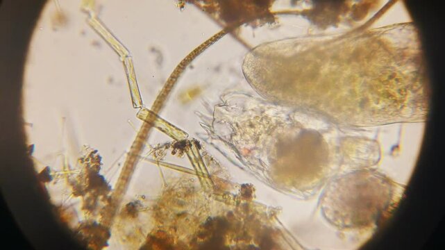 Stentor, sometimes called trumpet animalcules, are a genus of filter-feeding, heterotrophic ciliates, representative of the heterotrichs in waste water under the microscope.