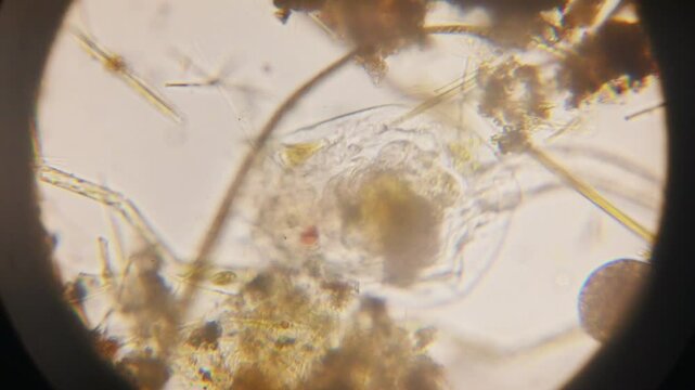 Stentor, sometimes called trumpet animalcules, are a genus of filter-feeding, heterotrophic ciliates, representative of the heterotrichs in waste water under the microscope.
