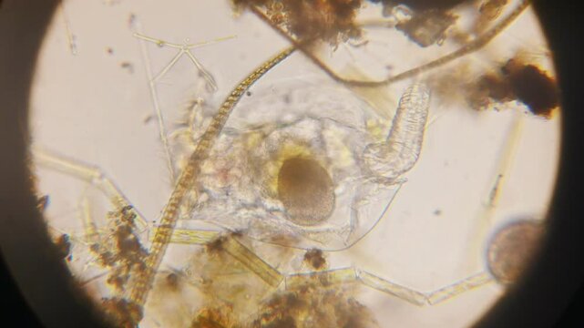 the movement of the infusorian Trichodina, which is a commensal, and is often absorbed into fish and hydras, under a microscope