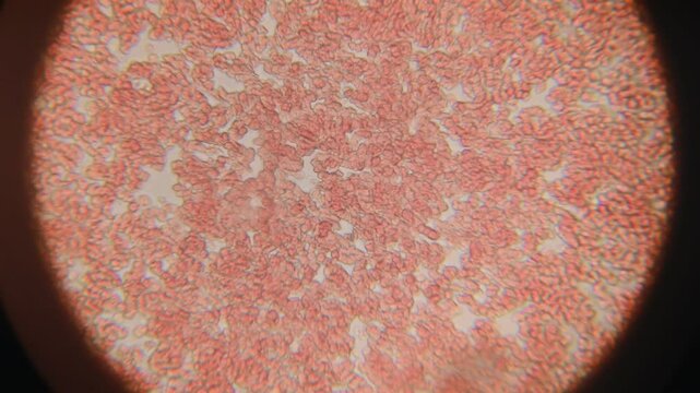 Movement of Cells Human Blood, Interstitial Fluid Research Using a Microscope.