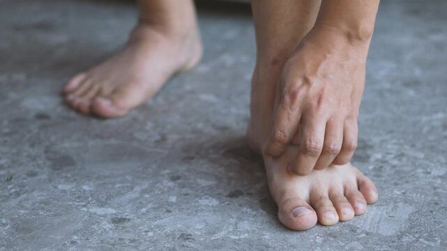 man hand scratch feet, itch foot, problem itchy skin on carpet at home, dermatitis from fungus, fungal bacterial infection, allergic reaction, eczema. Foot care concept