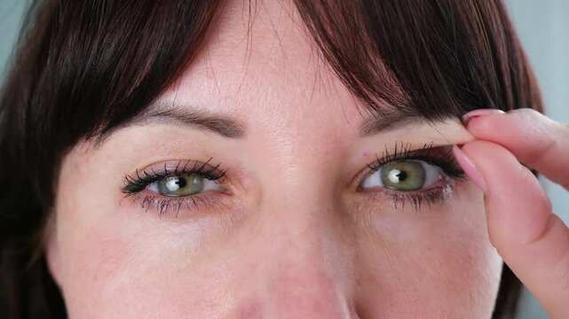 The woman has a drooping eyelid