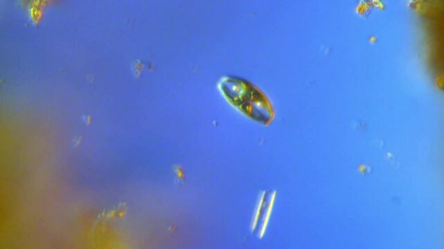 Amphora ovalis - Diatom under DIC microscope - 400x magnification