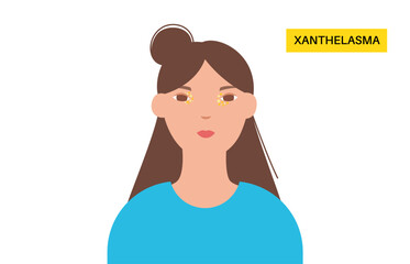 Xanthelasma skin disease