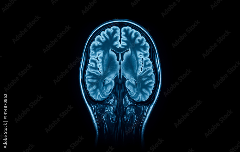 Poster high-resolution coronal brain mri scan in blue tones, clearly depicting neural structures and cerebr