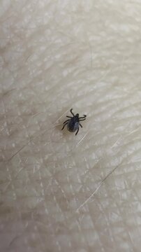 Eine schwarze Zecke krabbelt ein Handgelenk entlang und sucht nach einer guten Stelle