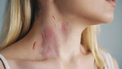 This image depicts a woman with visible skin issues on her neck.