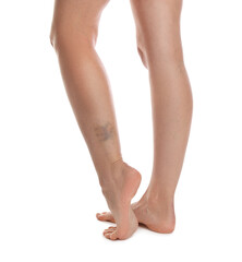 Woman with bruise on leg against white background, closeup