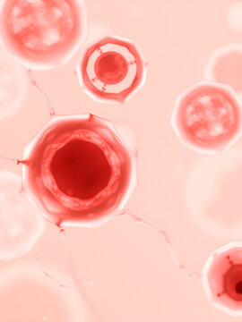 Microcytic, Macrocytic and Hypochromic Anemia