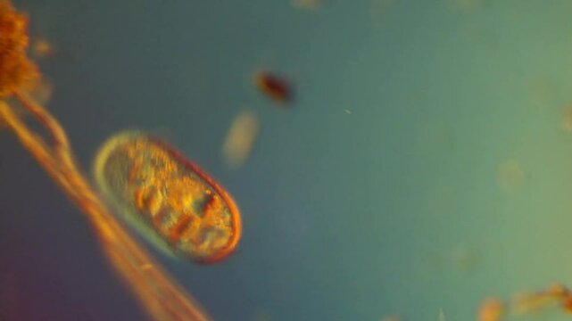 Frontonia sp. ciliated protist water microbe-200x DIC