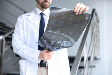Doctor examining brain MRI scan in clinic, closeup