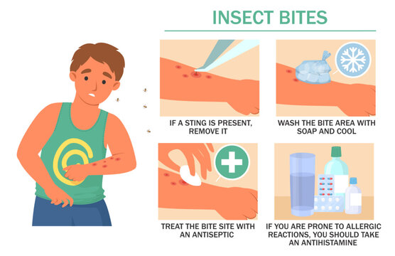 Illustrated steps for treating insect bites show how to remove stings, clean the area, apply antiseptics, and manage allergic reactions effectively.