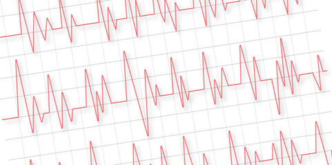 Heartbeat rate heart rhythm graph Checking your heartbeat for diagnosis. Cardiogram vector design line end of life background. Black heart beat diagram on red graph paper. ECG chart.