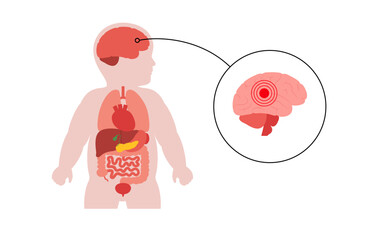 Brain diseases in a child