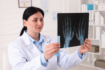 Doctor examining hand MRI scan in clinic