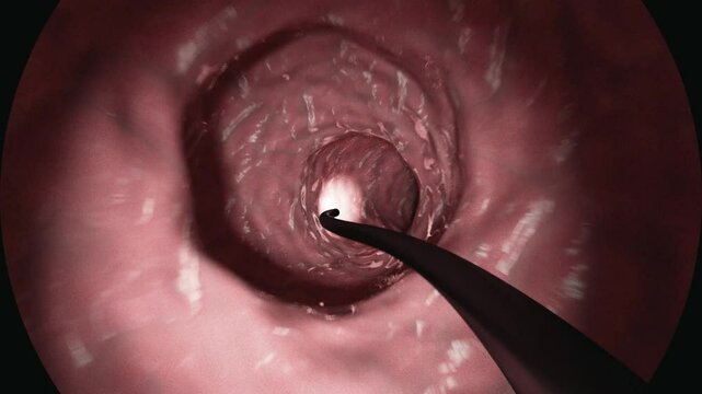 Medical Endoscopy View Inside Human Colon Illuminated Visibility of Pink Tissue and Flexible Tube Highlighting Intestinal Lining Texture and Structure