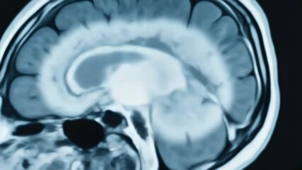 Human brain scan showing detailed anatomical structure, diagnosis imagery for medical research, healthcare, and neurology related concepts.