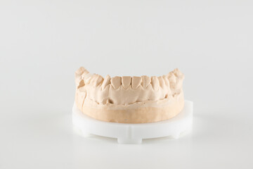 dental crown made of ceramics