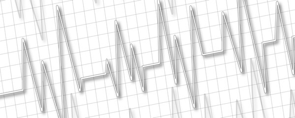 Heartbeat ecg electrocardiogram vector graph wave line. Heartbeat cardio rhythm line. ECG EKG electrocardiogram medicine test. Increasing amplitude pulse rate, sawtooth wave, increasing amplitude wave