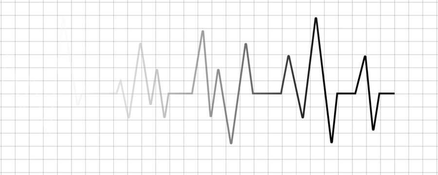Heartbeat ecg electrocardiogram vector graph wave line. Heartbeat cardio rhythm line. ECG EKG electrocardiogram medicine test. Increasing amplitude pulse rate, sawtooth wave, increasing amplitude wave