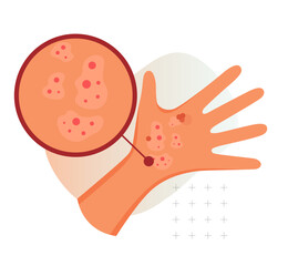 Skin Rashes and Spots as Symptoms - Icon