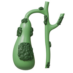 Medical and health science 3d icon. Gallbladder and bile duct affected by cancer.