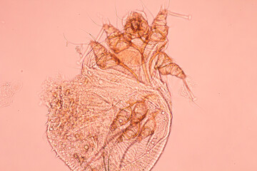 Image of pubic lice in microscopy from urine specimen.Pthirus pubis or Pediculosis pubis living...