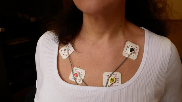 A woman with a holter on her body, who does a daily cardiogram control. Diagnosis of heart disease.