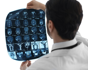 Doctor examining brain MRI scan on white background, back view