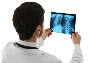 Doctor examining neck MRI scan on white background