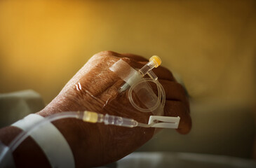 Saline intravenous solution in a patients hand