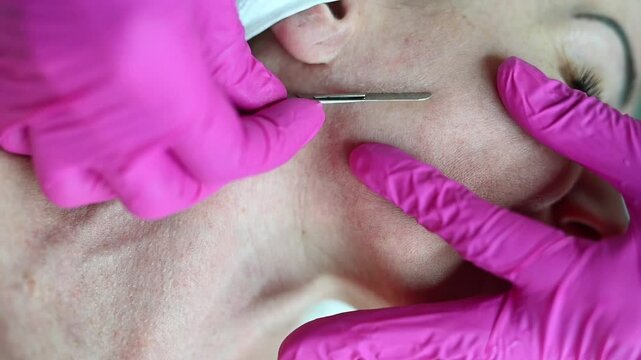 Dermaplaning facial close-up horizontal &mdash; A professional cosmetologist gently exfoliates dead skin cells using a sterile scalpel. Horizontal video, macro detail, smooth skin results, skincare procedur