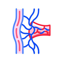 Fototapeta premium Arteriovenous Malformation (AVM) Diagram in Brain, Color Illustration