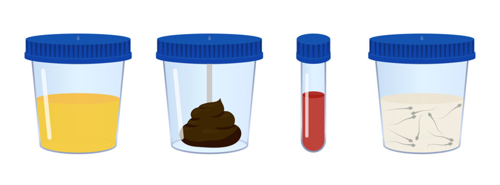 Medical analysis containing urine, feces, blood and sperm samples