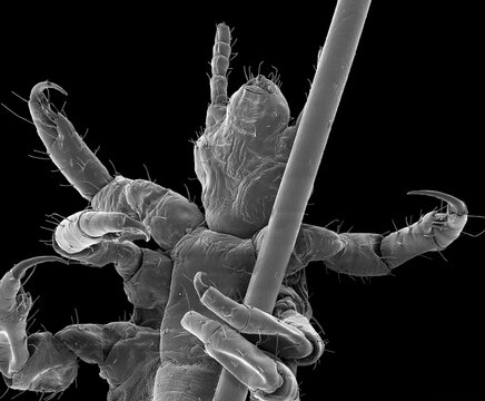 Head louse, SEM