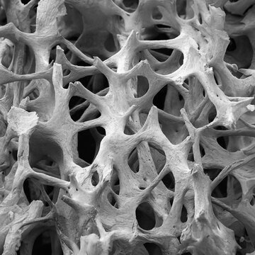 Bone tissue, SEM