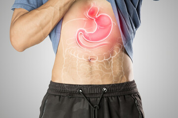 Hiatal Hernia causes upper stomach bulge, shown in medical illustration.
