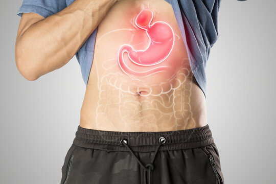 Hiatal Hernia causes upper stomach bulge, shown in medical illustration.