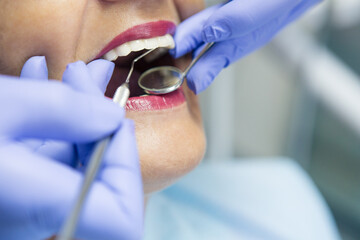 Portraits of patients in dental office having a dental check. Shallow DOF. Developed from RAW;...