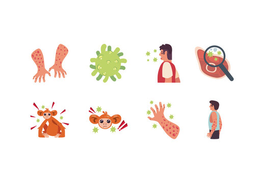 Colorful Medical Monkey Pox Symptoms Illustration Set