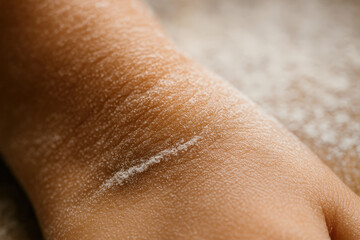 Close up of skin with flour dust on hand surface