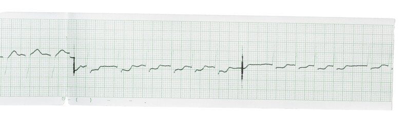 Vintage paper and documents from scratch, grunge details, elements for graphic design, realistic photography png isolated on transparent background