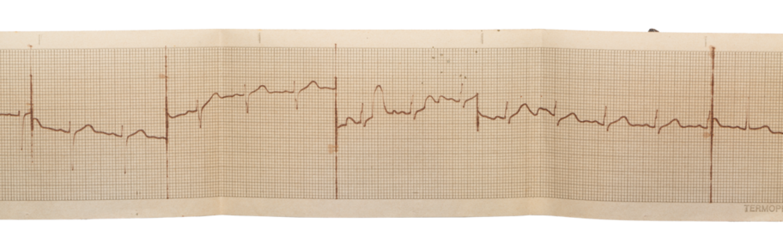 Vintage paper and documents from scratch, grunge details, elements for graphic design, realistic photography png isolated on transparent background