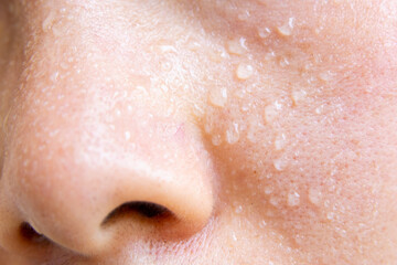 Fototapeta premium Close-up of a woman's face sweating in the hot summer