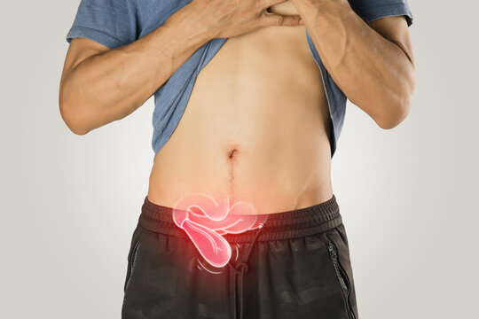 Hernia symptoms shown in body illustration.